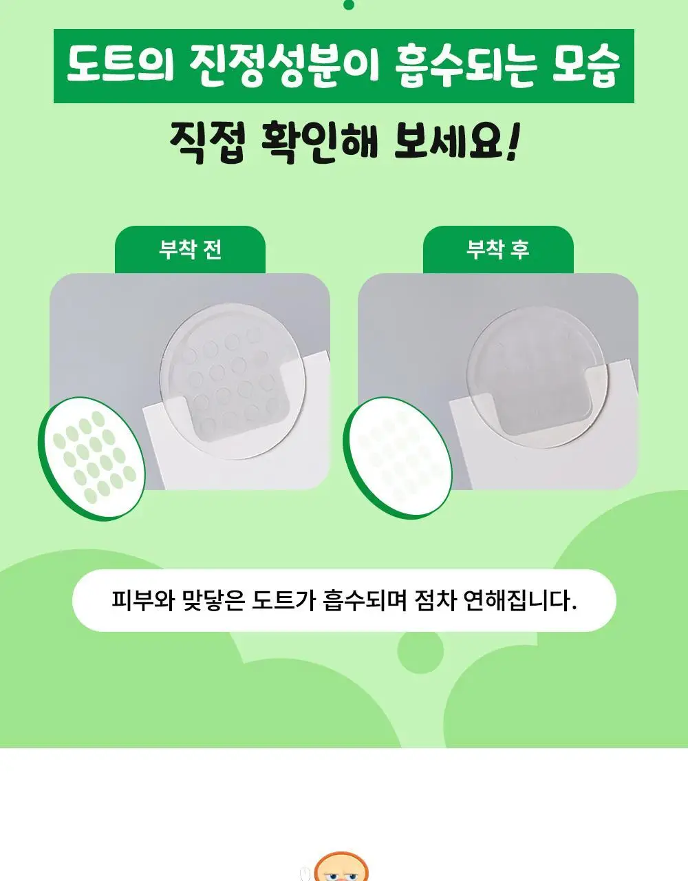 [진정패치] 아크로패스 짜닷 도트패치 45매입 상세페이지 8